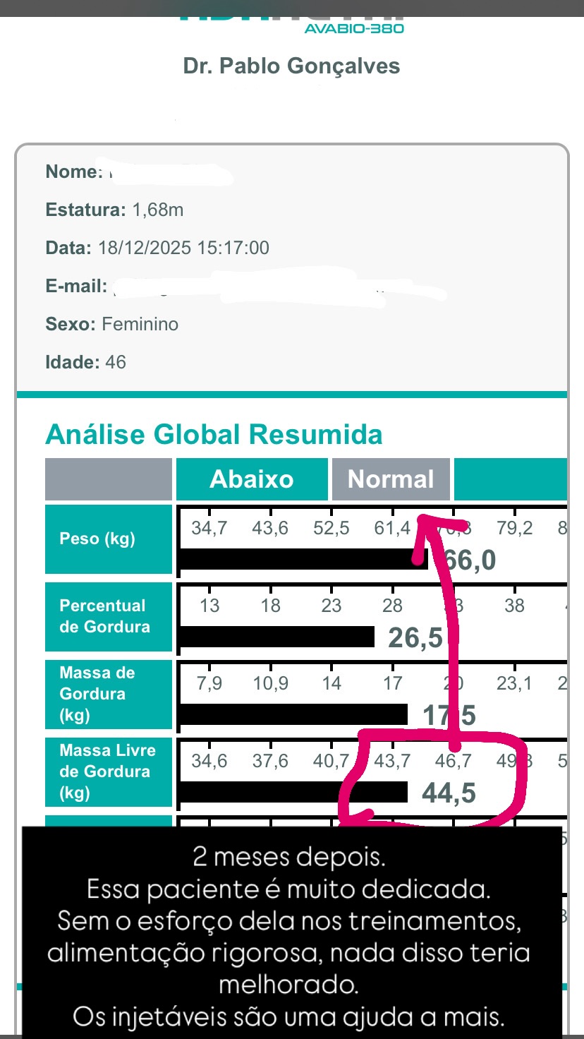 Resultado de composição corporal após 2 meses